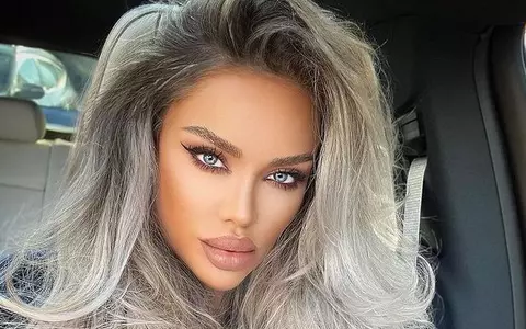 Bianca Drăgușanu face publice imaginile cu ea desfigurată, după ce a fost snopită în bătaie: "Am greșit pentru că am tăcut și am iertat"