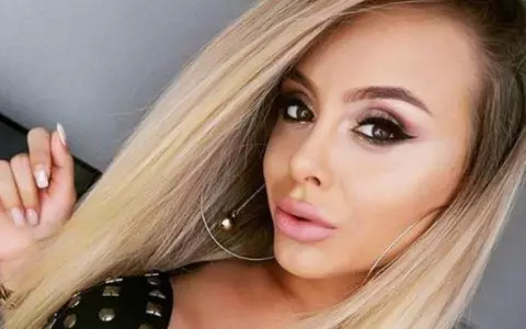 Ispita Irina Stroia de la Insula Iubirii se confruntă din nou cu cancerul: "Este șocul psihic, am 25 de ani"