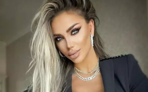 Bianca Drăgușanu și-a făcut implant de sprâncene. Ce probleme are după intervenție