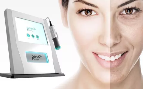 (P) Tot ce trebuie să știi despre rejuvenare facială Oxygeneo !