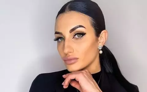 Ana Porgras s-a accidentat grav la Survivor. A publicat fotografiile cu rănile și cicatricile