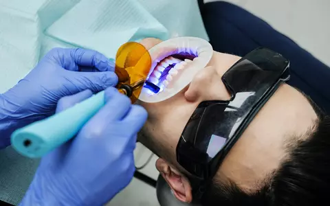 (P) Un zâmbet perfect cu fațetele dentare