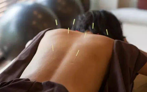 (P) Care sunt cele mai importante afecțiuni tratate prin acupunctură?