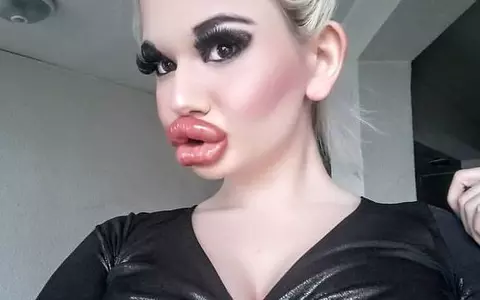 Femeia cu cele mai mari buze din lume s-a operat din nou! Andrea Ivanova e de nerecunoscut: "Nu există limite"