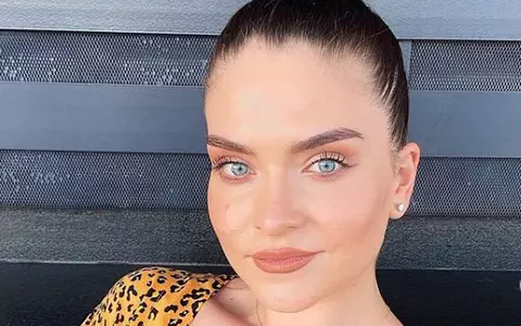 Adelina are picioarele pline de semne, după Survivor. Războinica a publicat imaginile