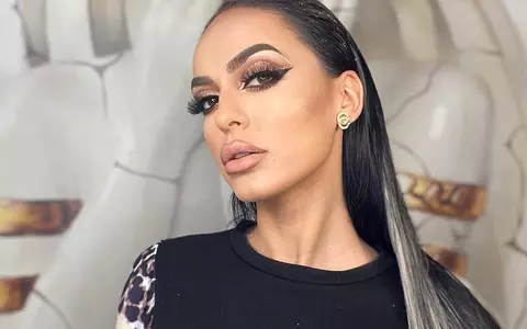 Irina Lepa a sunat la Salvare, după ce a suferit o reacție alergică: "Ceva foarte grav..."
