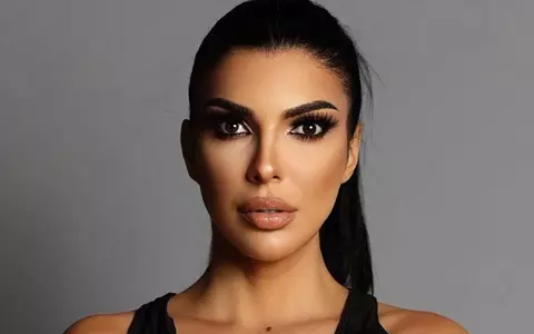De ce a apărut Andreea Tonciu plină de bandaje la cap, înainte de Survivor România: „Părea vânătă lângă ochi”