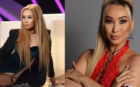 De ce a avut Xonia fața umflată la Survivor. A suferit o alergie puternică: "Corpul meu s-a adaptat greu"