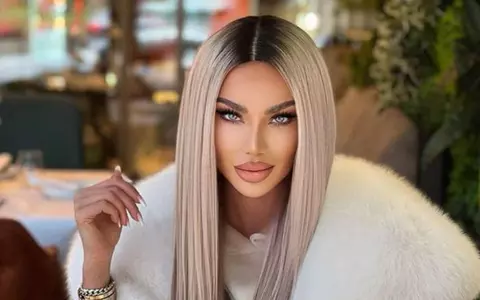 Bianca Drăgușanu și-a făcut încă o intervenție estetică la buze: "Procedeul e de durată"