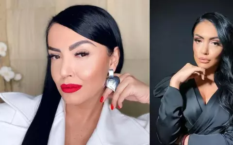 Andreea Mantea are din nou probleme cu tenul: "Este ceva rău"