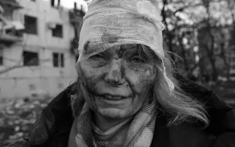 Femeia rănită din Ucraina, adevărul despre poza cu ea, devenită virală: „Totul este real. Iată bucățile de sticlă care au rămas în mine”