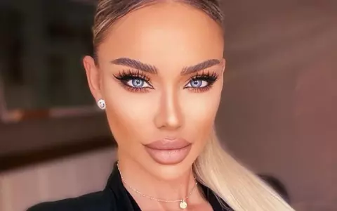 Cum arată Bianca Drăgușanu după ce și-a schimbat forma buzelor: "Sunt multe intervenții de care am nevoie"