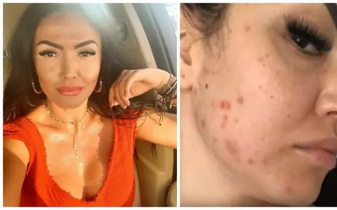 Andreea Mantea a aflat cauza problemelor de sănătate: "Mă umflu toată și mă umplu de pete și de bube!"