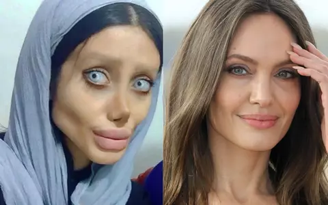 Cum arăta Sahar Tabar, tânăra care a vrut să semene cu Angelina Jolie, înainte de cele 50 de operații estetice