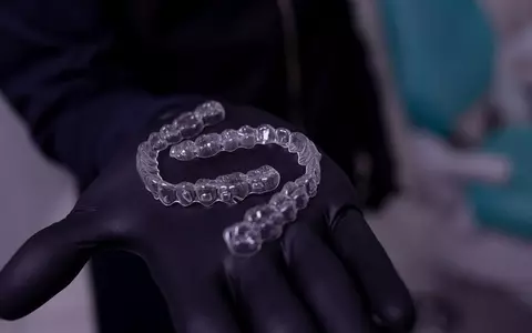 Cum alegi un aparat dentar potrivit problemelor tale? 3 recomandări