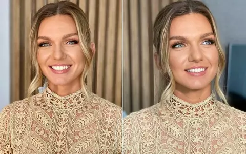 Cum arată Simona Halep la o săptămână de la operația la nas: "Mereu avem un motiv să zâmbim"