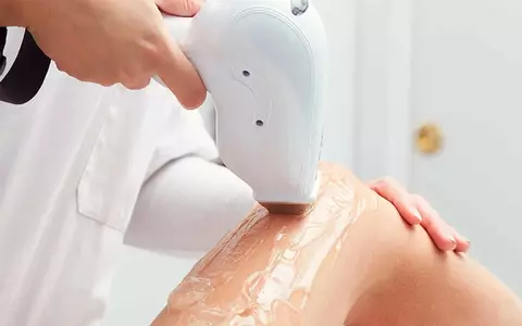 Tot ce trebuie să știi despre epilarea cu laser!