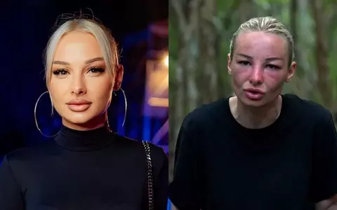 Cum arăta Maria Lungu înainte de Survivor 2023. De ce s-a umflat la față în junglă: ”Apar afecțiuni asociate sindromului...”