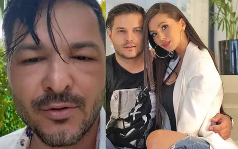 „Începe să se și înnegrească”. Liviu Vârciu s-a afișat cu fața umflată, din vacanța din Maldive. Ce a pățit prezentatorul TV