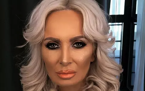 ”Am rămas cu niște traume. Nu sunt dependentă, dar...”. Ce operații estetice are Daniela Gyorfi, dar și ce o deranjează la aspectul fizic