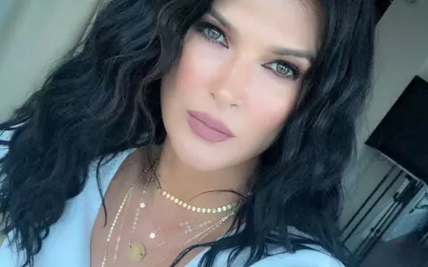 Monica Bârlădeanu a spus cum scapă de coșuri peste noapte, la 44 de ani: "Un episod acneic, dacă e absolut punctual, îl rezolvi foarte bine cu un bețișor de urechi pe care îl..."