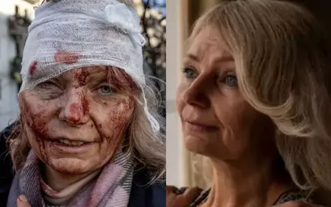 Femeia-simbol a războiului din Ucraina, interviu pentru români, la un an după ce a fost rănită în bombardament: "Am avut patru operații. E foarte greu când, noapte de noapte, visezi rachete, explozii..."