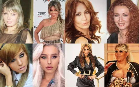 Cum arătau vedetele înainte de operațiile estetice. Raluca Bădulescu și Alina Ceușan au trecut printr-o transformare radicală