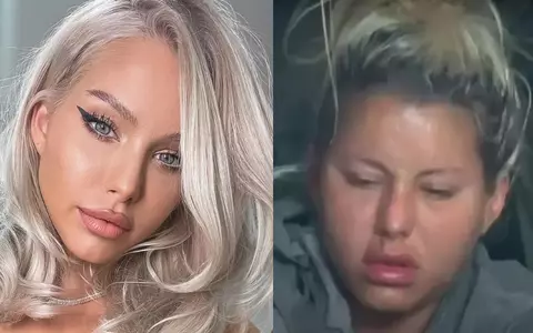 Carmen Grebenișan a apărut cu fața umflată, după trei luni la Survivor 2023: "Apar afecțiuni, boli legate de..."