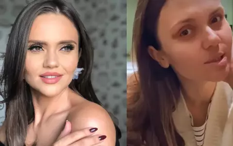 Cristina Șișcanu a apărut cu ochiul vânăt pe Instagram: "Nu vă imaginați ce durere a fost"