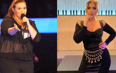 Oana Radu, cu abdomenul la vedere, după operația de abdominoplastie: "Am așteptat 29 de ani să postez asta"