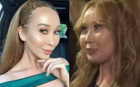 Cum se simte Xonia și ce dietă ține, după ce a avut grave probleme de sănătate din cauza unei boli autoimune: ”Nu îmi doresc să se confrunte nimeni cu așa ceva...”