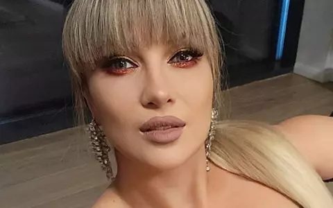 De ce boală suferă Lora: „Eram umflată și simțeam că mă ține pielea. Mă bucur tare că am aflat”. Ce operații estetice are artista / EXCLUSIV