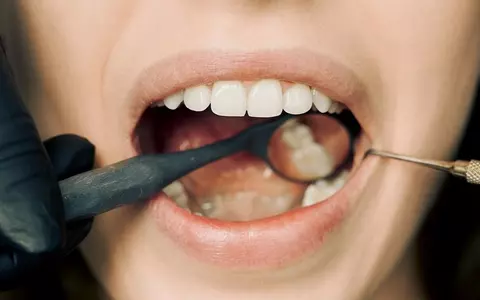 Reabilitarea dentară: necesitate medicală sau cerință estetică? Află la Implant Studio