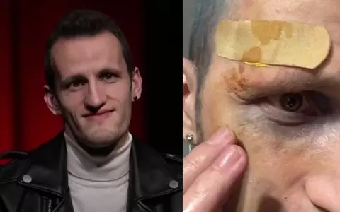 Andrei Ungureanu, aka Omul cu Tourette, a povestit că a fost bătut la metrou, dar acum susține că totul a fost o farsă: "M-a rupt cu bătaia"