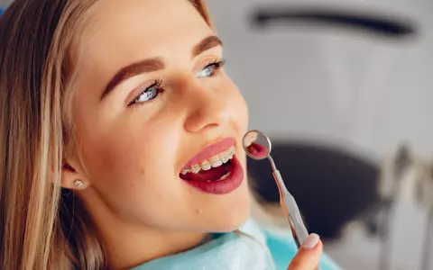 5 recomandări de la specialiști după aplicarea aparatului dentar