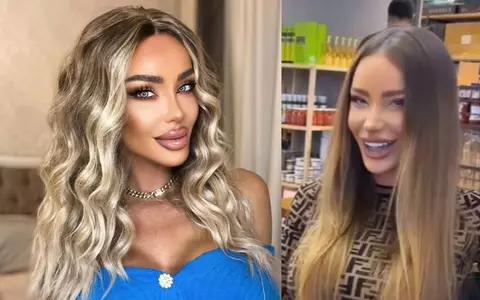 Bianca Drăgușanu s-a filmat fără filtre de înfrumusețare și cu buzele învinețite, după operația estetică de 11.000 de euro: ”Sunt în proces de update, ca la telefon...”