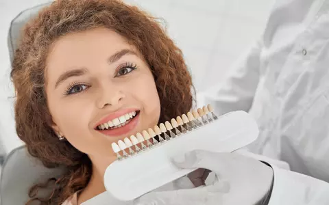 După ce criterii se aleg fațetele dentare