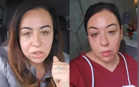 Oana Roman are noi probleme de sănătate. S-a filmat cu un ochi umflat și lăcrimând: „Va trebui să mă duc la spital”