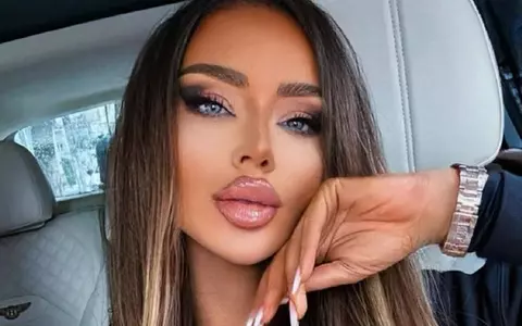 Bianca Drăgușanu s-a filmat alături de un bărbat care conducea o Skoda Octavia, după despărțirea de Gabi Bădălău. Vedetei nu-i plăcea această mașină, în trecut: „Viața bate filmul. M-am răzgândit, sunt foarte fericită!”