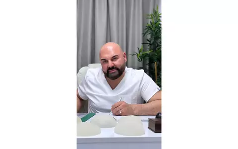 Dr. Ben: Transformând vieți prin liftingul facial