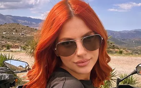 Lidia Buble a suferit de psoriazis și susține că s-a vindecat după ce tatăl ei s-a rugat, pentru ea: „Nu mi s-au mai înmulțit petele, cele care au fost efectiv au dispărut de tot. Sunt trei săptămâni de când nu mai am nimic”