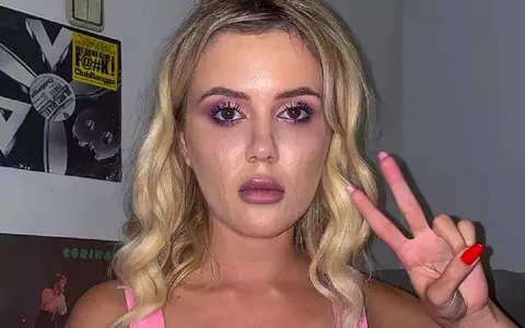 Emily Burghelea, după prima operație pe urma accidentului din Mauritius: „Am rămas cu o gaură în cap. Oasele feței s-au mișcat. Acel fier îmi străpungea capul și...”. Cât durează perioada de recuperare