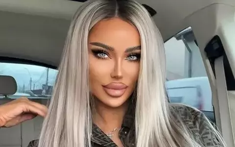 Bianca Drăgușanu își micșorează buzele, din nou: "Zici că am fost chioară atâția ani. Le-am topit de 5 ori și tot nașpa le-am reinjectat"