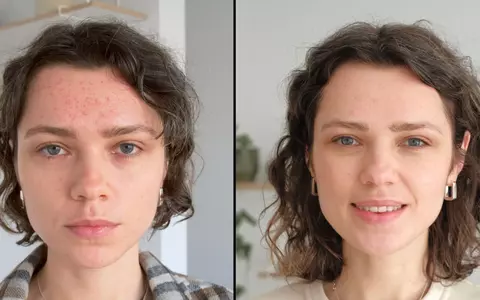 Cum să alegi produsele de make-up potrivite dacă ai cicatrici post-acneice?