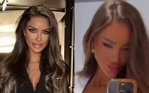 Bianca Drăgușanu și-a făcut o nouă intervenție estetică, la ochi, după despărțirea de Gabi Bădălău: „Vă prezint...”