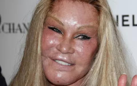 Jocelyn Wildenstein, alias Catwoman, a murit. De ce s-a stins din viață vedeta, celebră pentru operaţiile estetice extreme