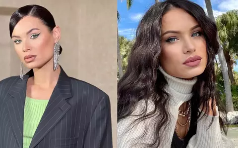 Irisha, desfigurată de o alergie. Influencerița are fața umflată și ochii iritați: „Nu mai știu ce să fac"