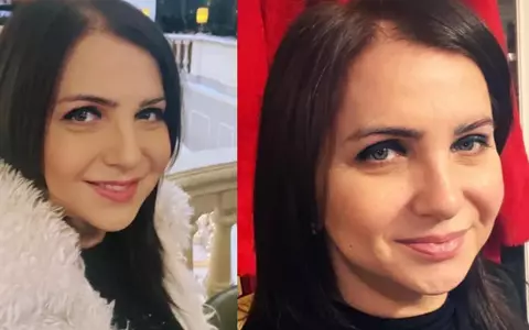 Carmen Șerban a ajuns de nerecunoscut după ce și-a făcut mai multe operații estetice la față. La 54 de ani, arată mai tânără cu 20: „Mi-am făcut un lifting facial"