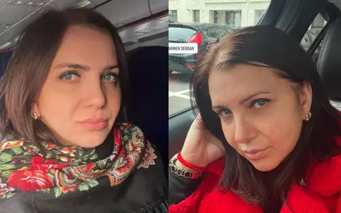 Carmen Șerban, complicații în urma unui lifting facial: "Mi-a apăsat pe un nerv și... Am perfuzii aproape zilnice". Cum se simte acum