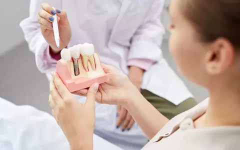 Cum să alegi clinica potrivită pentru implantul dentar?